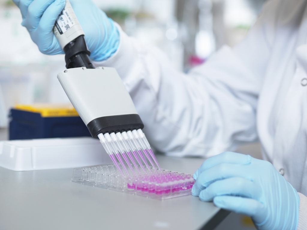 [02-0801182] Human IgG ELISA (96 Determinations)
